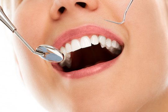 dental check-ups wodonga