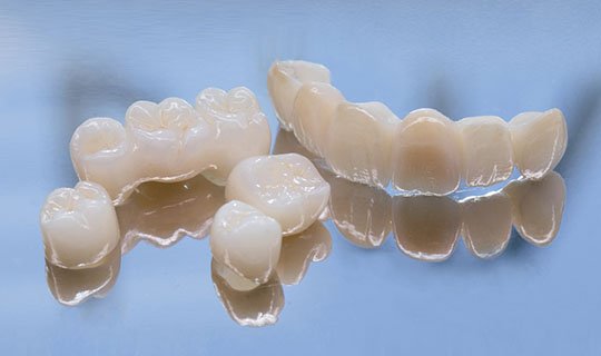 dental bridges wodonga