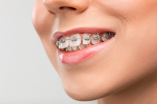 orthodontics wodonga