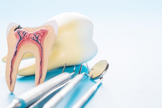 root canal treatment wodonga