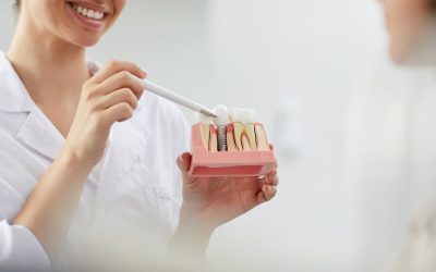 Restoring Smiles: Exploring Replacement Choices for Missing Teeth
