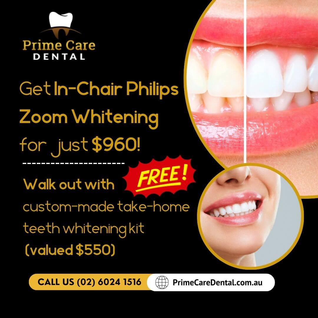 in-Chair philips zoom whitening promo banner