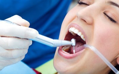 Benefits of Dental Cleaning