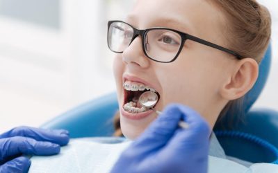 Orthodontics: A Complete Guide to Straightening Your Smile