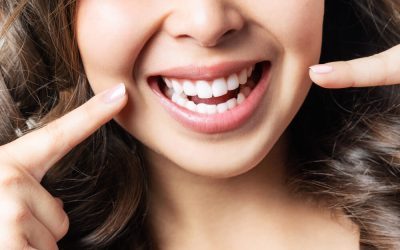 How Long Does Teeth Whitening Last and How to Maintain the Results