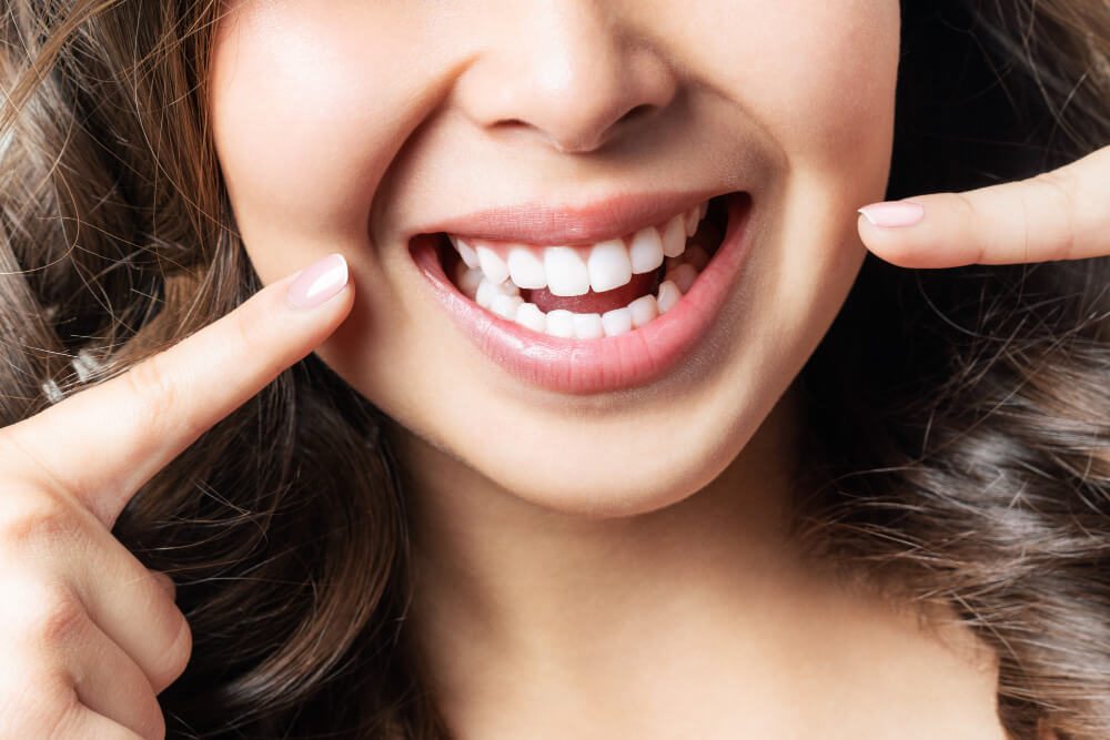 How Long Does Teeth Whitening Last and How to Maintain the Results